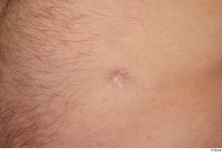 Steve Q belly scar skin 0003.jpg